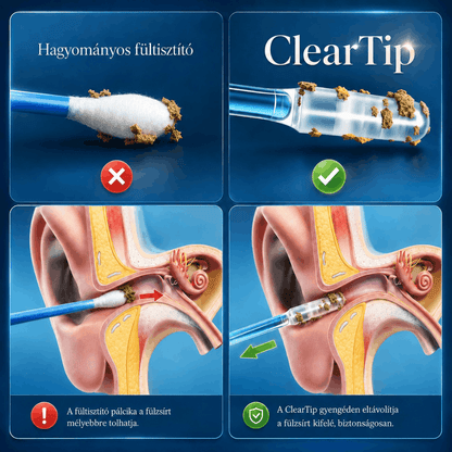 ClearTip (24 darab)