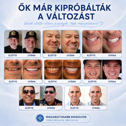 DentLux™