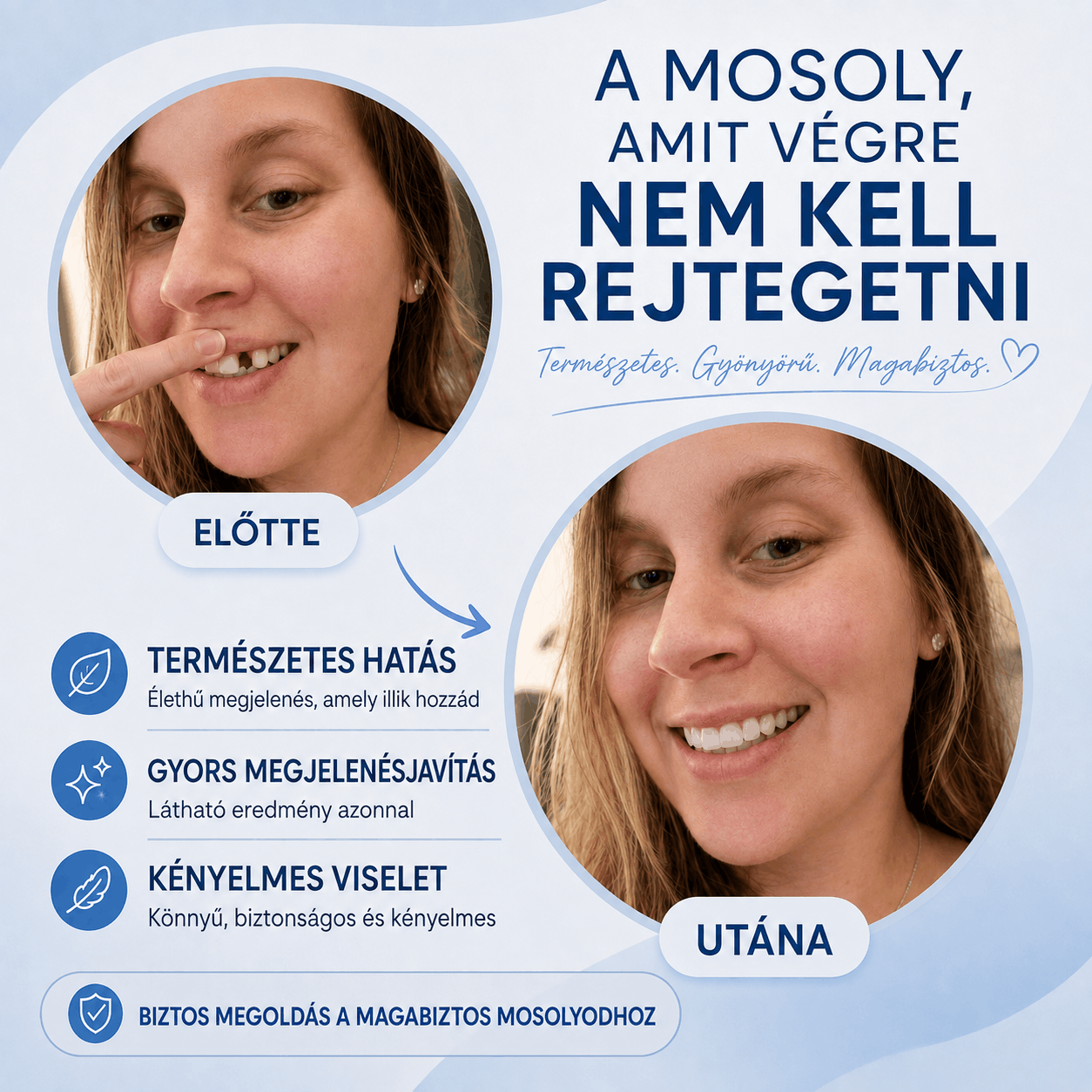 DentLux™